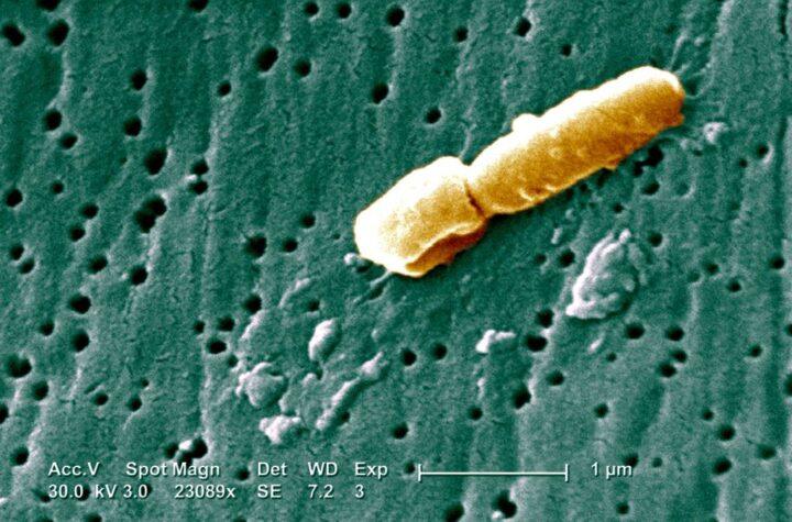 Infección urinaria: cómo una bacteria puede afectar el cerebro dos años después