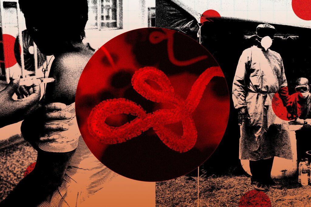 "Expertos advierten sobre el brote de ébola: lo más aterrador desde la pandemia de COVID 19"