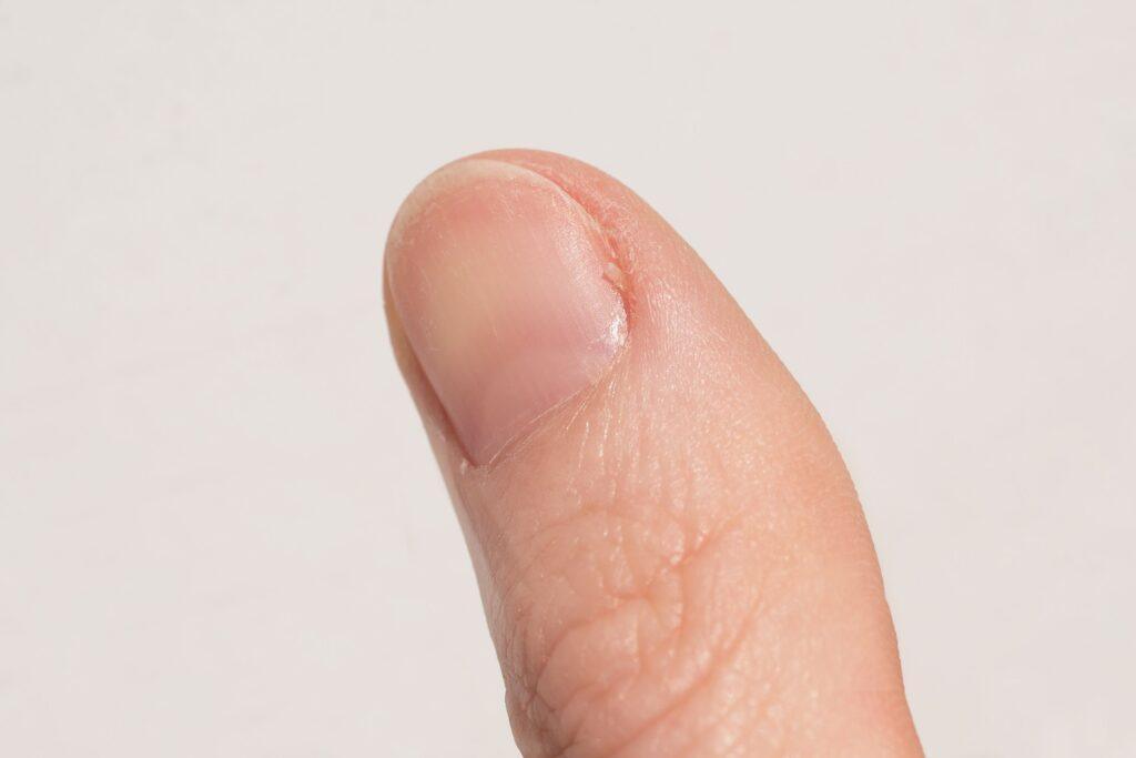 Descubre cómo el color de tus uñas puede revelar importantes señales sobre tu salud