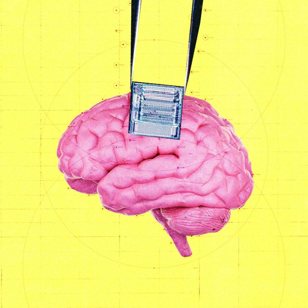 Innovador implante cerebral financiado por OpenAI y Peter Thiel para la detección temprana del cáncer
