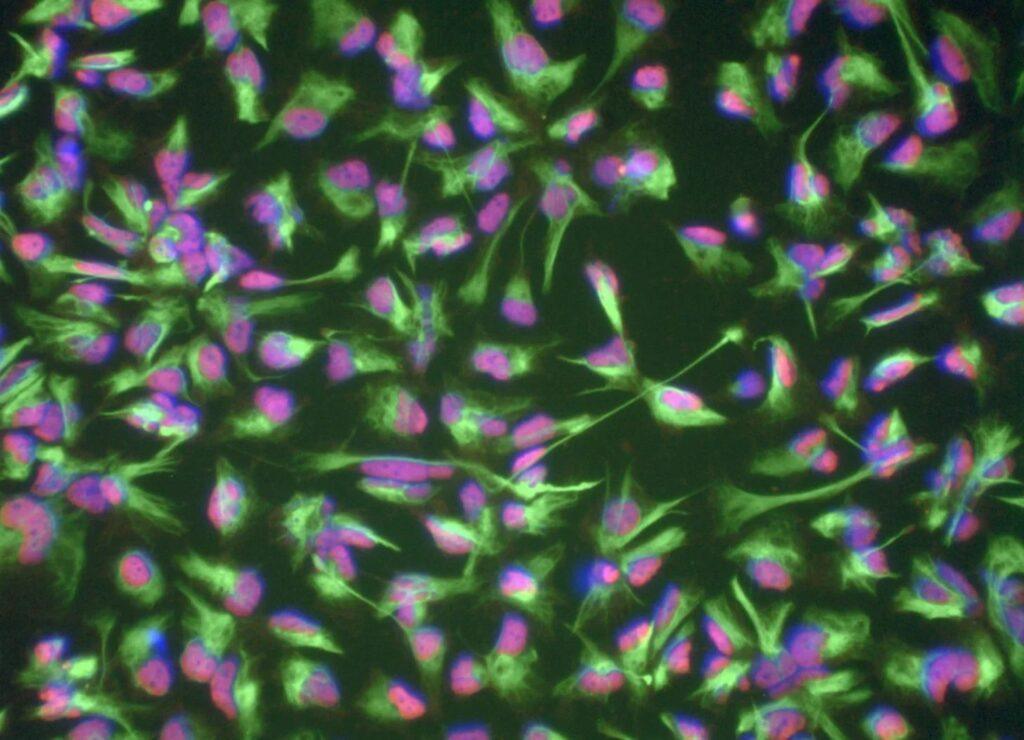 Científicos rejuvenecen células humanas reprogramándolas: ¡de 80 a 20 años en un instante!