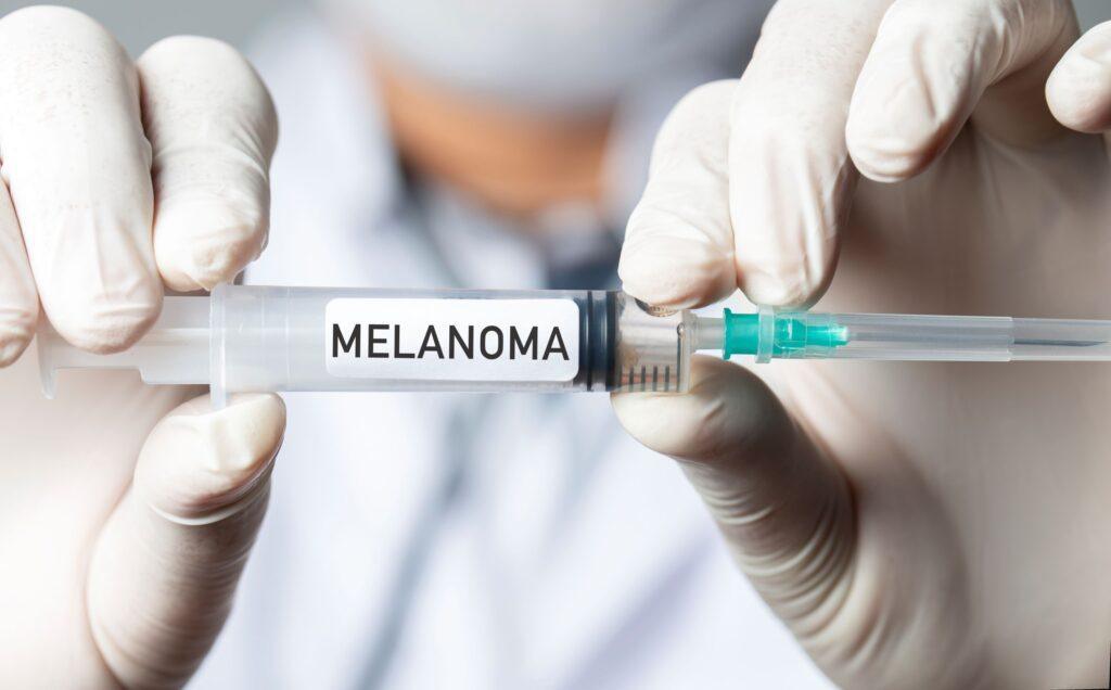 Revolución en el Tratamiento del Melanoma: Vacuna Experimental Reduce el Riesgo de Recaída en un 40%